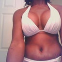 Bikini 10 days post-op