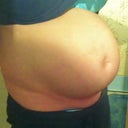 Due in a month? --NO, just an 8 inch muscle separation!