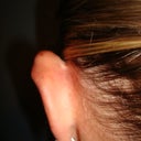 Left ear before