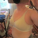 1 month post op