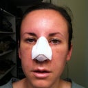 day 3. at my most swollen