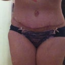 2.5 weeks po