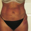 1 day after