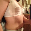 Before Pic Side View