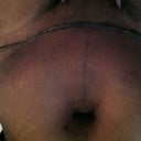 Belly button hole looks huge!!yikes