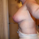 5weeks left lateral