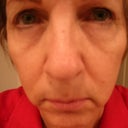 $10,000 FACE LIFT