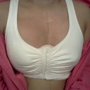 right after surgery