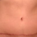 Eleven weeks post op, pre workout
