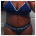 9 days post op
