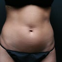 My before photo