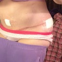 My right side.  And BB No blood.