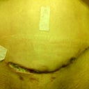 6 1/2 weeks post op :( better? I don't know...