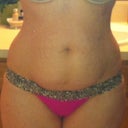 I don't think I have a bad shape, so I think the Lipo will really help bring it out, thinking I should maybe do my inner thighs too, or maybe it will be included??
