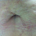 One stop Stretch Mark shop