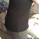 This is jest a few days post op with binder on.