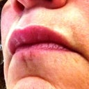 Angled view