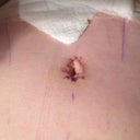 Bellybutton anyone?