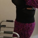 1 week post op