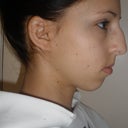 profile view before