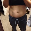 Two days before surgery