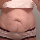 My Belly2