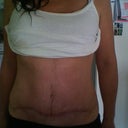 post up - 9 weeks
