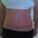 post up 9 weeks