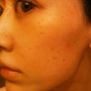 5 days after