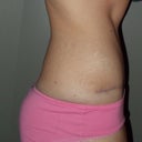 8 months