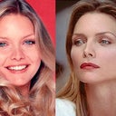 In Dec. Oasis is having a great special on Perlane.  I'm going to get Michelle Pfiffer lips:)