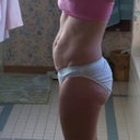 Tummy tuck pre-op