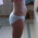 tummy before tummy tuck