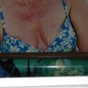 Before shot in bikini top...this top had no support at all.  the bikini tops i was wearing before BA was VS, full padded, and push up!  i don't really have many pics of myself...lots of my dogs though! lol