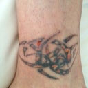 Ankle, 3 weeks after 4th treatment