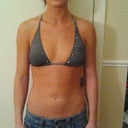 Before Implants