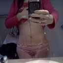2 weeks PO facing