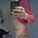2 weeks PO sideways