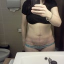 6 weeks PO facing (not as tight as 2 weeks)