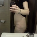 6 weeks PO sidways (swollen)