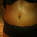 9 days post op, flatter, but swollen