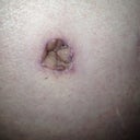 new belly button