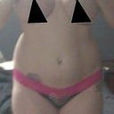 This was me in January 2011 when I starting thinking about the procedure.