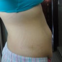 BEFORE: Side view standing