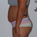 gross...side view
