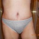23 days post op no more grannie panties