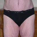 7 wk after TT