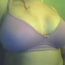 14 days post op