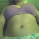 14 days post op