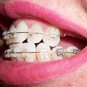 5th before adjustment.  The left side is terrible and being pulled unevenly.  The wire is sticking out.